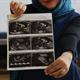 سونوگرافی سه ماهه اول بارداری با روش پیشرفته